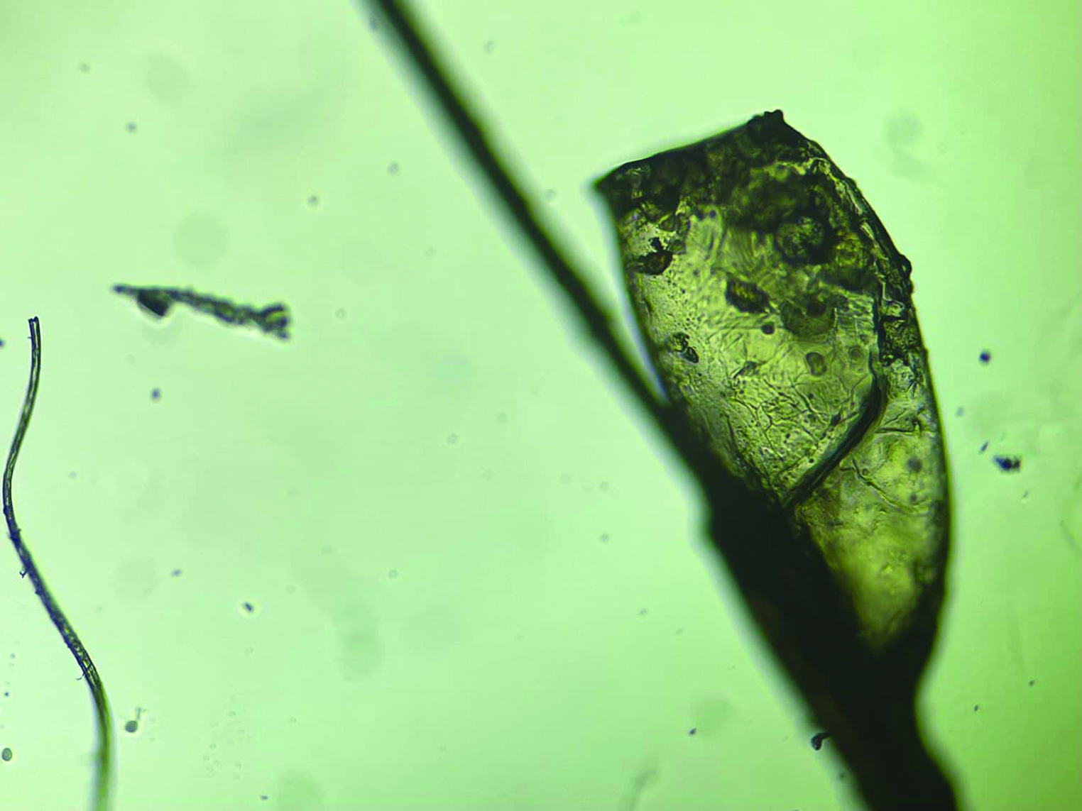 Nit of pediculosis capitis observed under high power (40×).