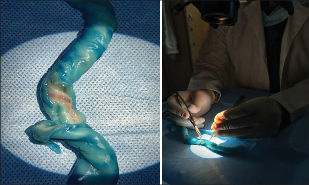Use of human umbilical cord in microsurgery training.