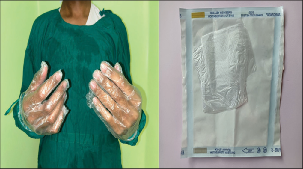 Transparent sterilized polythene glove.