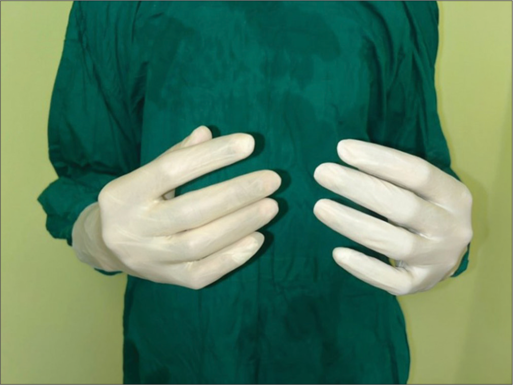 Latex glove worn over transparent sterilized polythene glove.