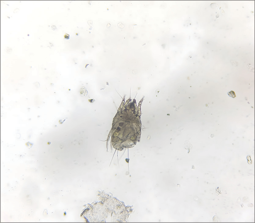 The mite Otodectus cynotis demonstrated in 10% potassium hydroxide mount test.