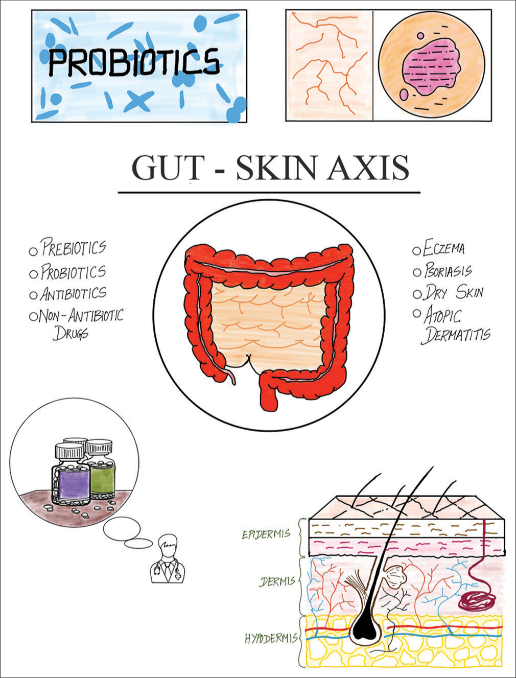 Overview of the gut-skin axis illustrated by Thangamuni A. and Mohan J.