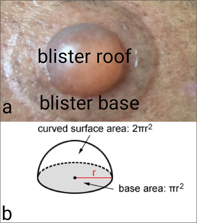 (a and b) Areas of circle (base) and hemisphere structure like blister of radius r and its relation. π: Pi (=3.14), r: Radius of circle/rim of device/blister and of hemisphere/blister.