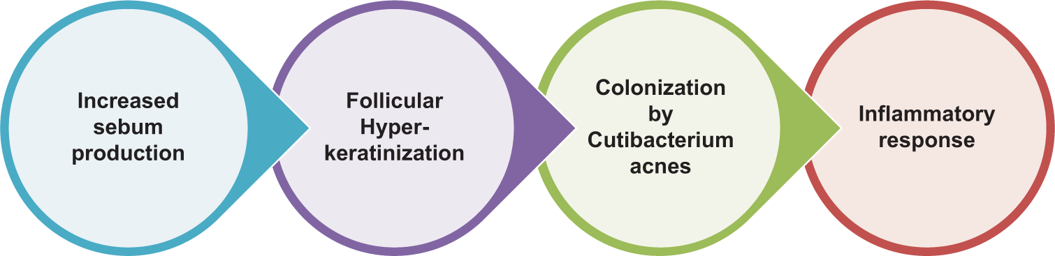 Pathophysiology of acne.