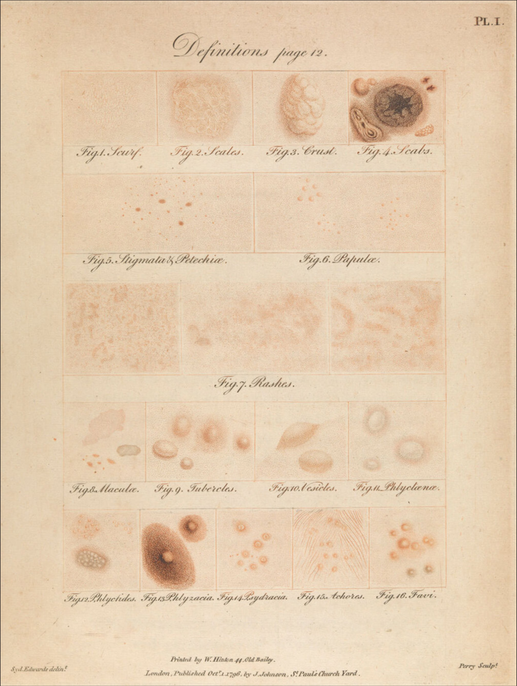 “Definitions” of lesions (Credits: Reproduced from Wellcome Library/CC BY 4.0./Public domain. Permission is not required as the source is under a creative commons license in public domain).