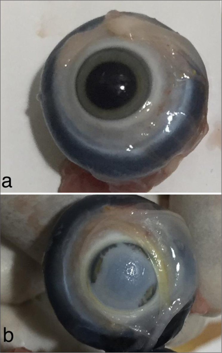 (a) Clear cornea of the eyeball without ointment before cautery. (b) Frosted cornea after cautery.